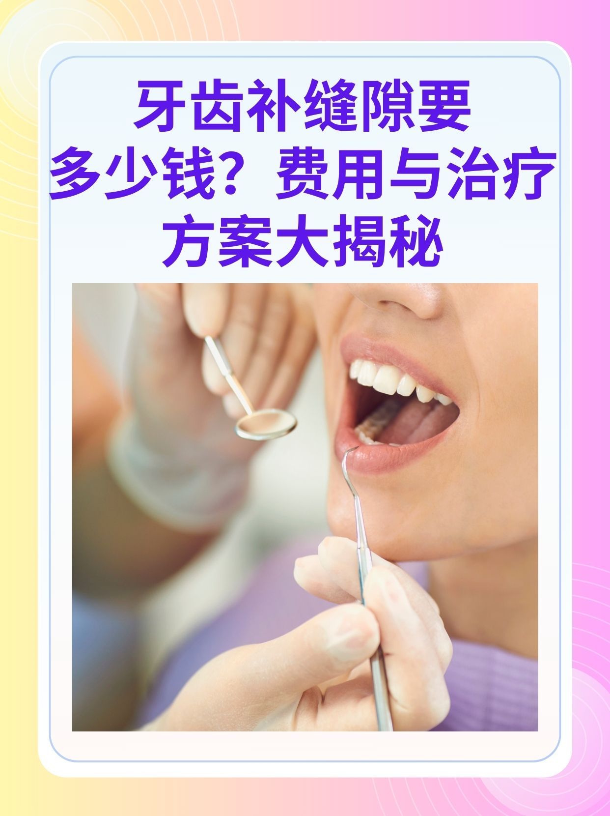 白山补牙医保可以报销吗(补牙医保可以报销吗 哪些可以报销呢)